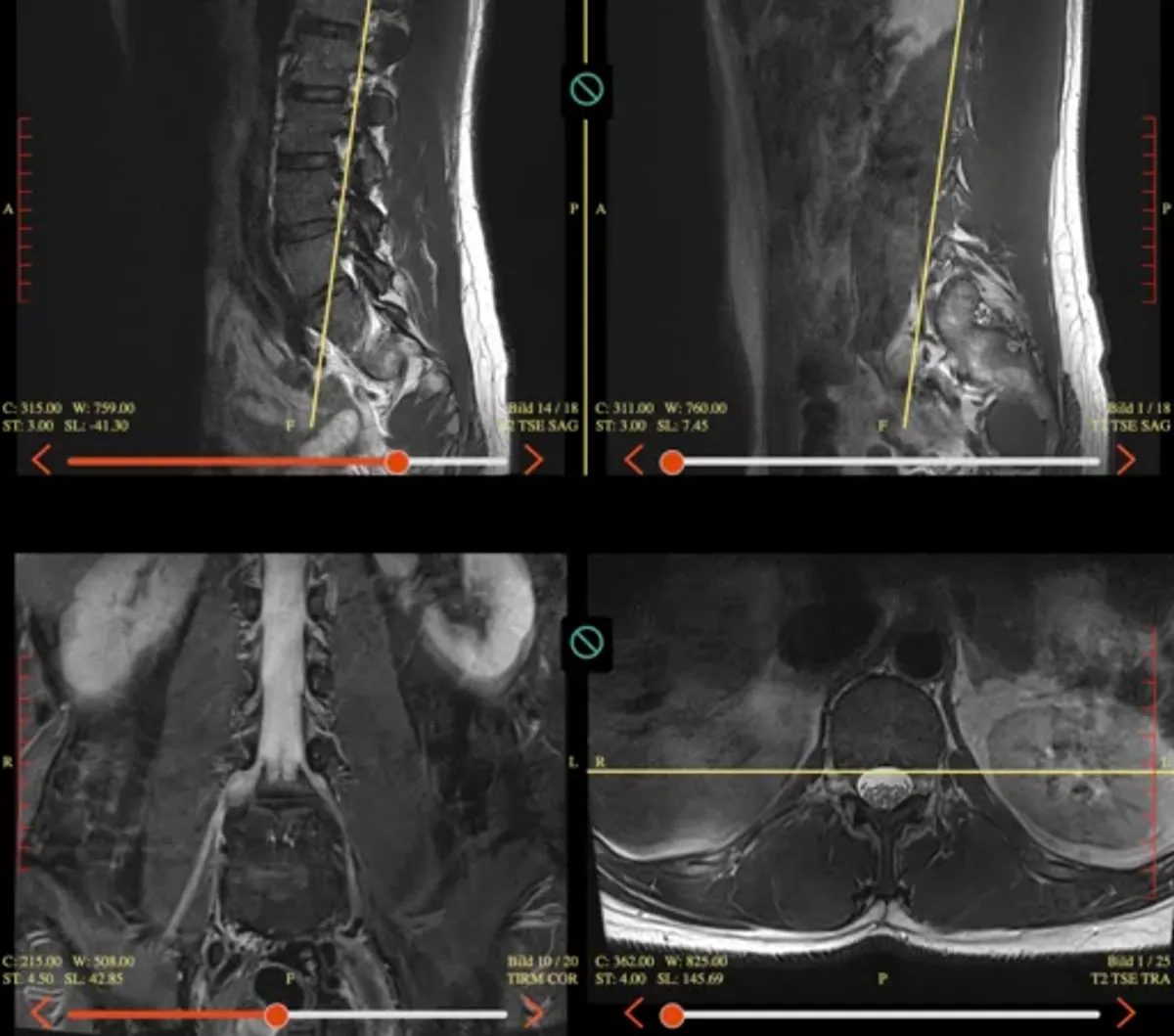 MRI scan that inspired the developer to build a more efficient workout tool